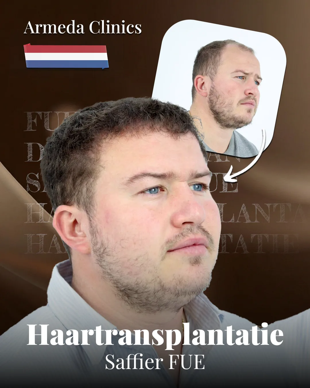 Situatie voor en na de behandeling naast elkaar