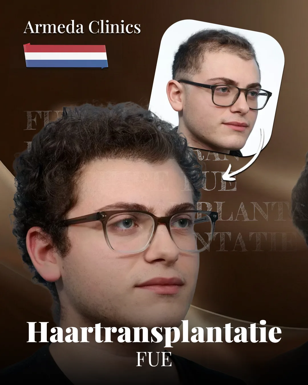 Situatie voor en na de behandeling naast elkaar