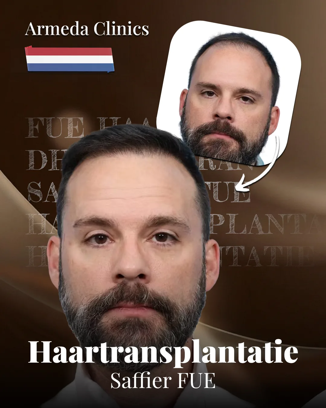 Situatie voor en na de behandeling naast elkaar