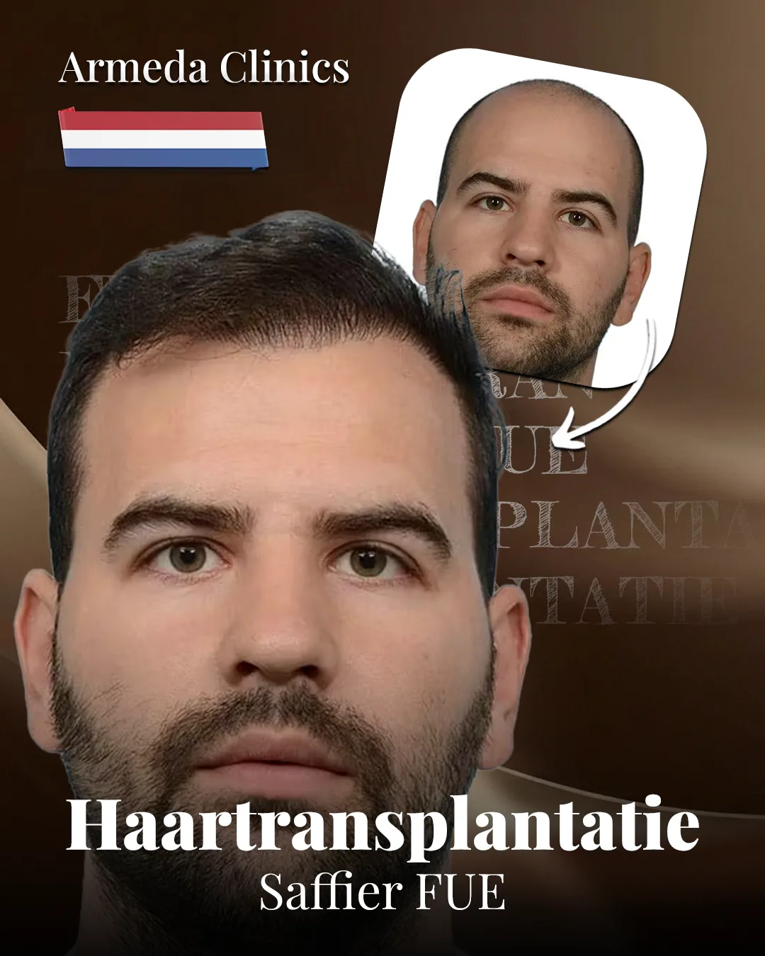 Situatie voor en na de behandeling naast elkaar