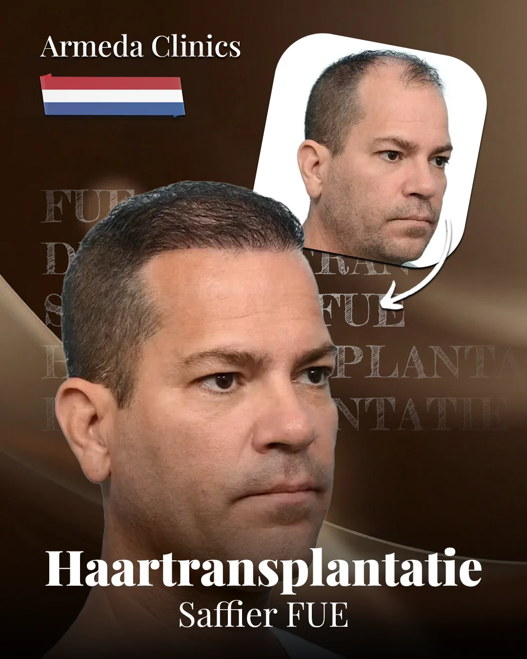 Situatie voor en na de behandeling naast elkaar