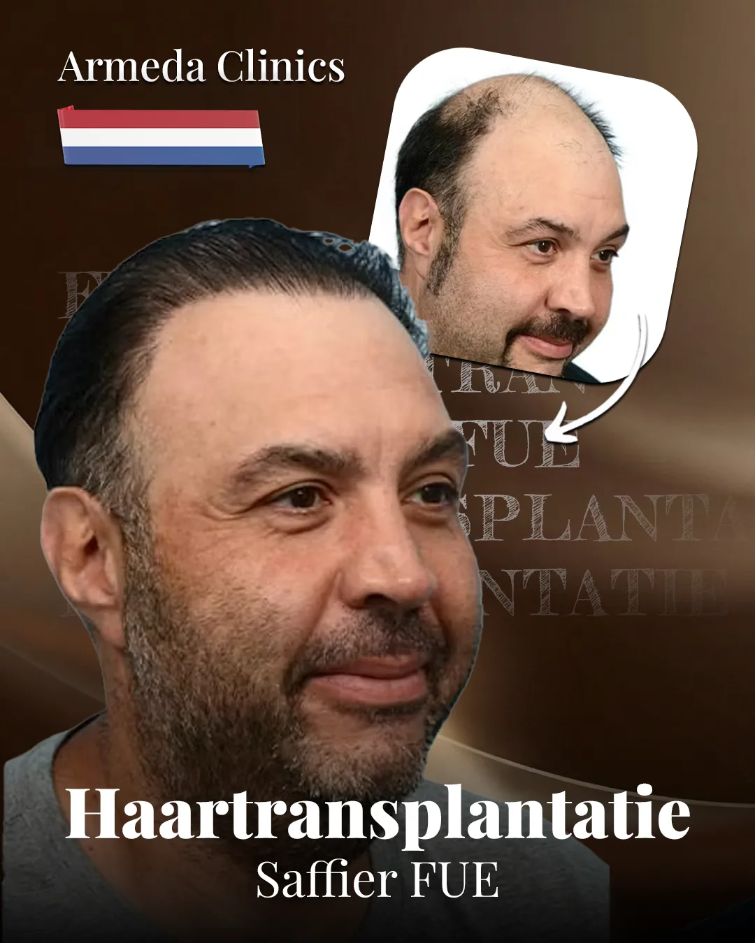 Situatie voor en na de behandeling naast elkaar
