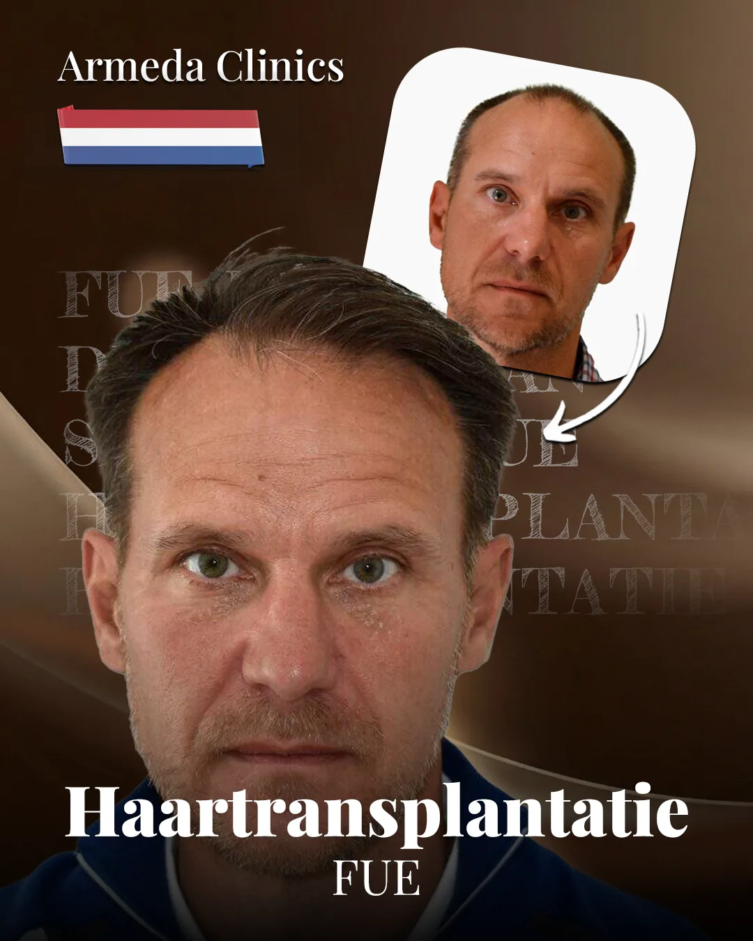 Situatie voor en na de behandeling naast elkaar