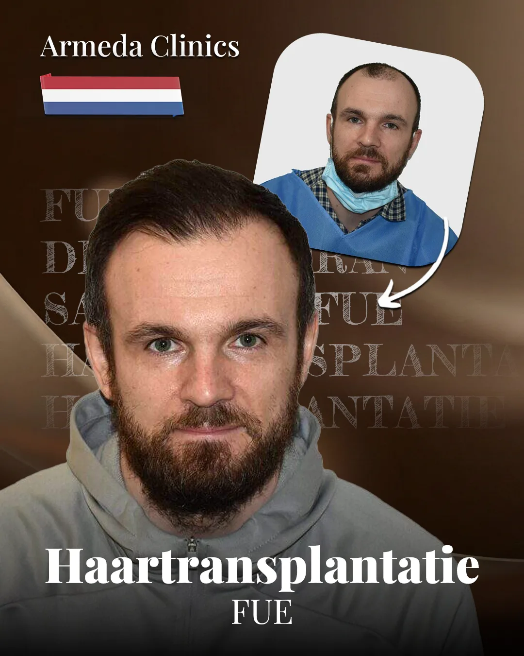 Situatie voor en na de behandeling naast elkaar