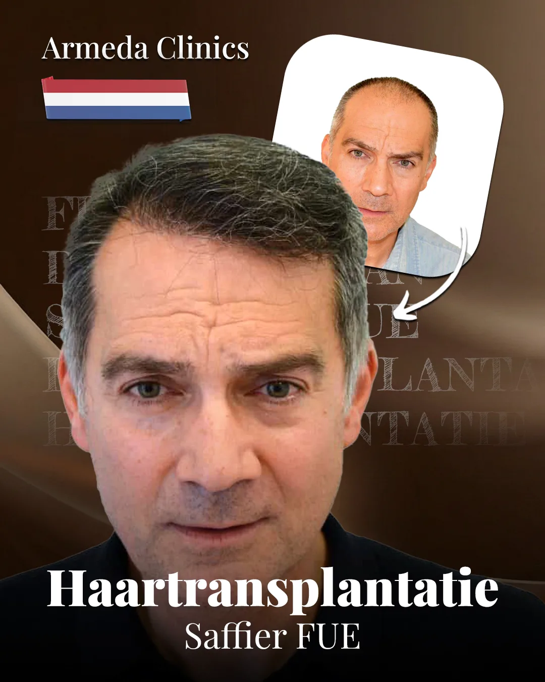 Situatie voor en na de behandeling naast elkaar