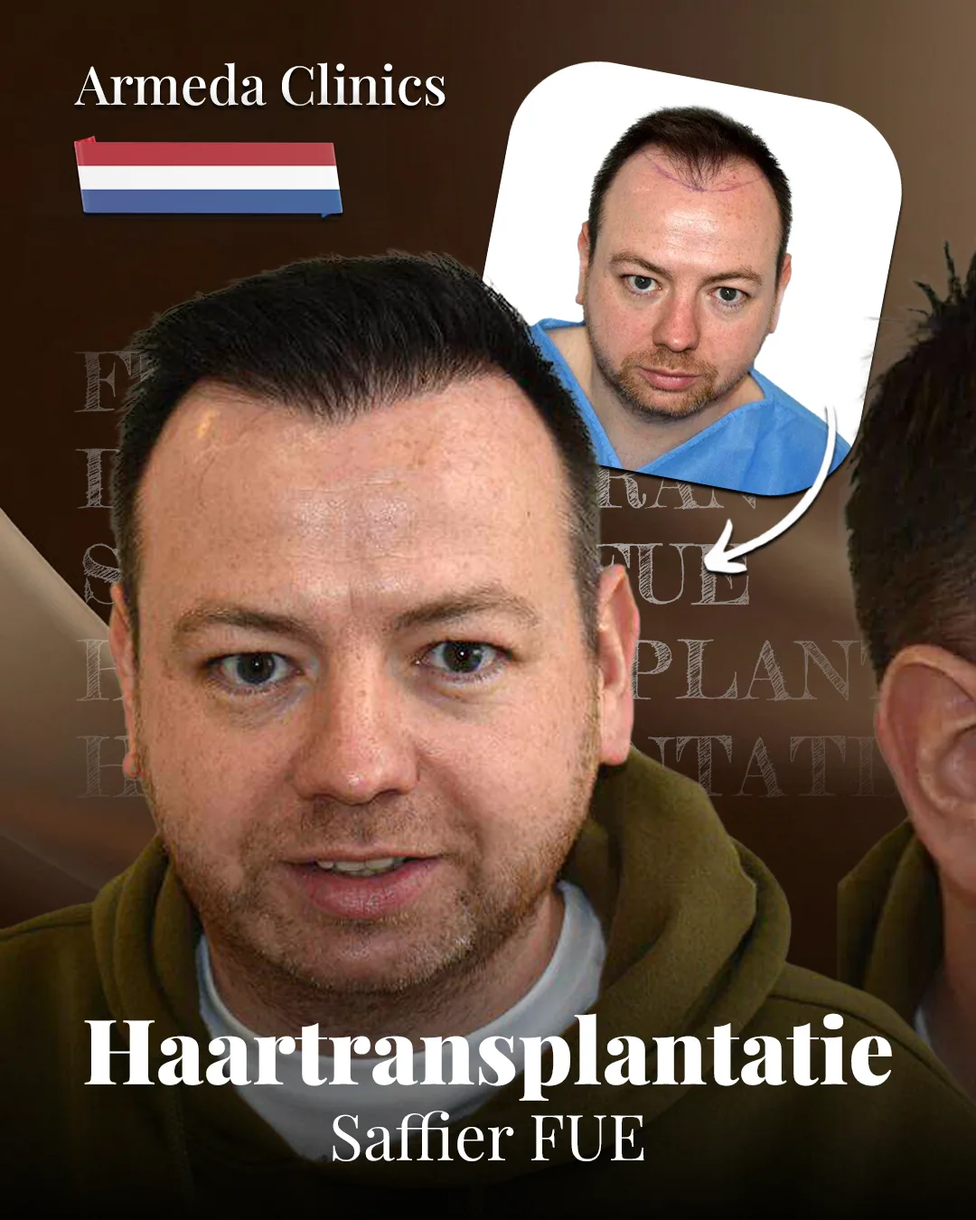 Situatie voor en na de behandeling naast elkaar