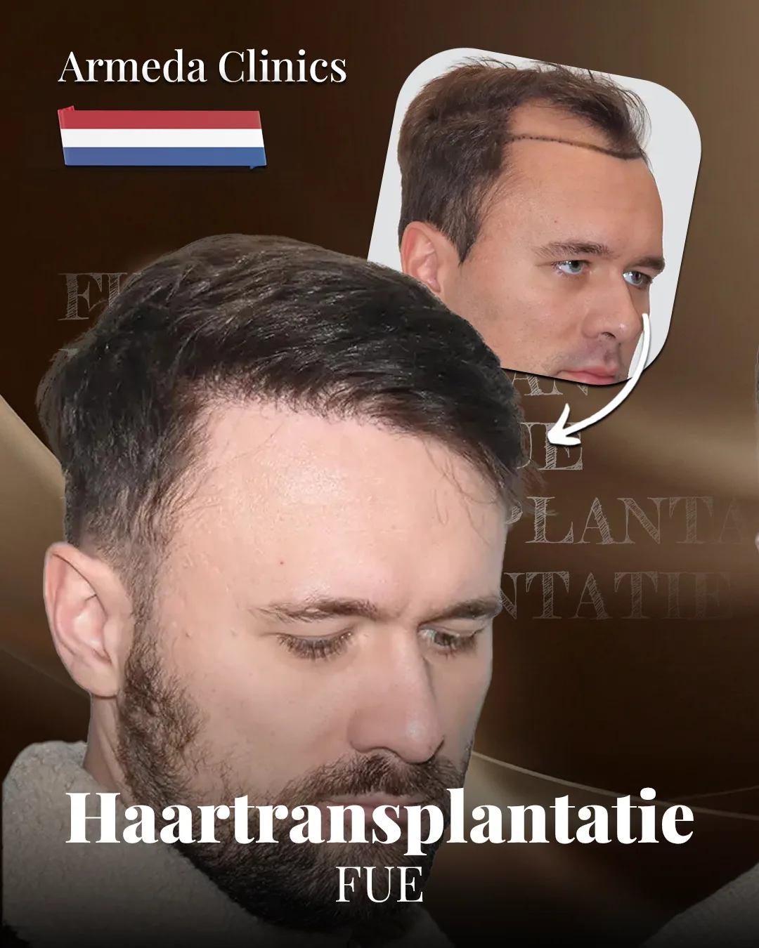 Situatie voor en na de behandeling naast elkaar