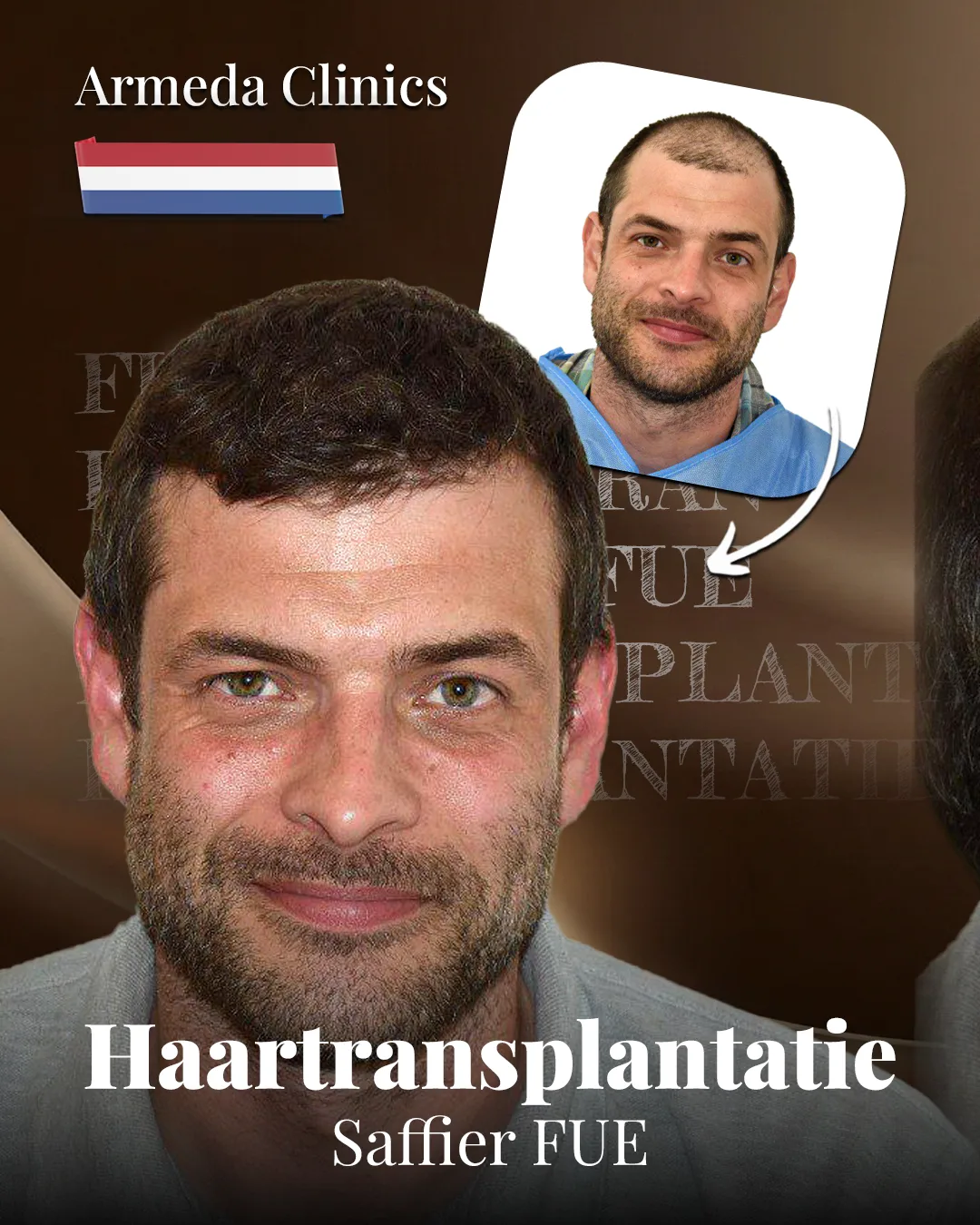 Situatie voor en na de behandeling naast elkaar