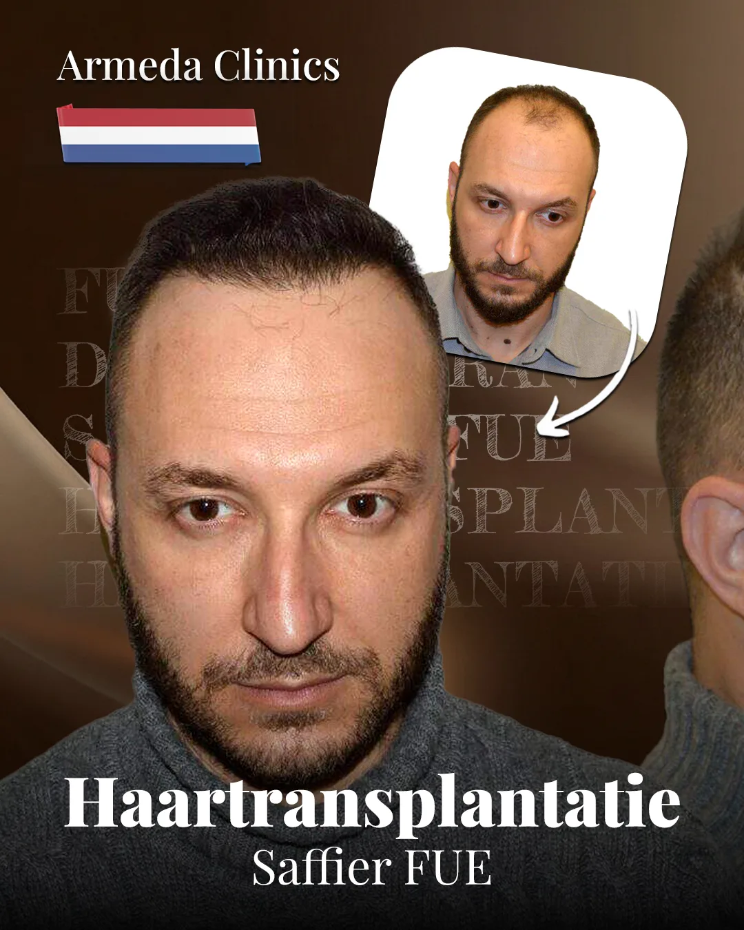 Situatie voor en na de behandeling naast elkaar