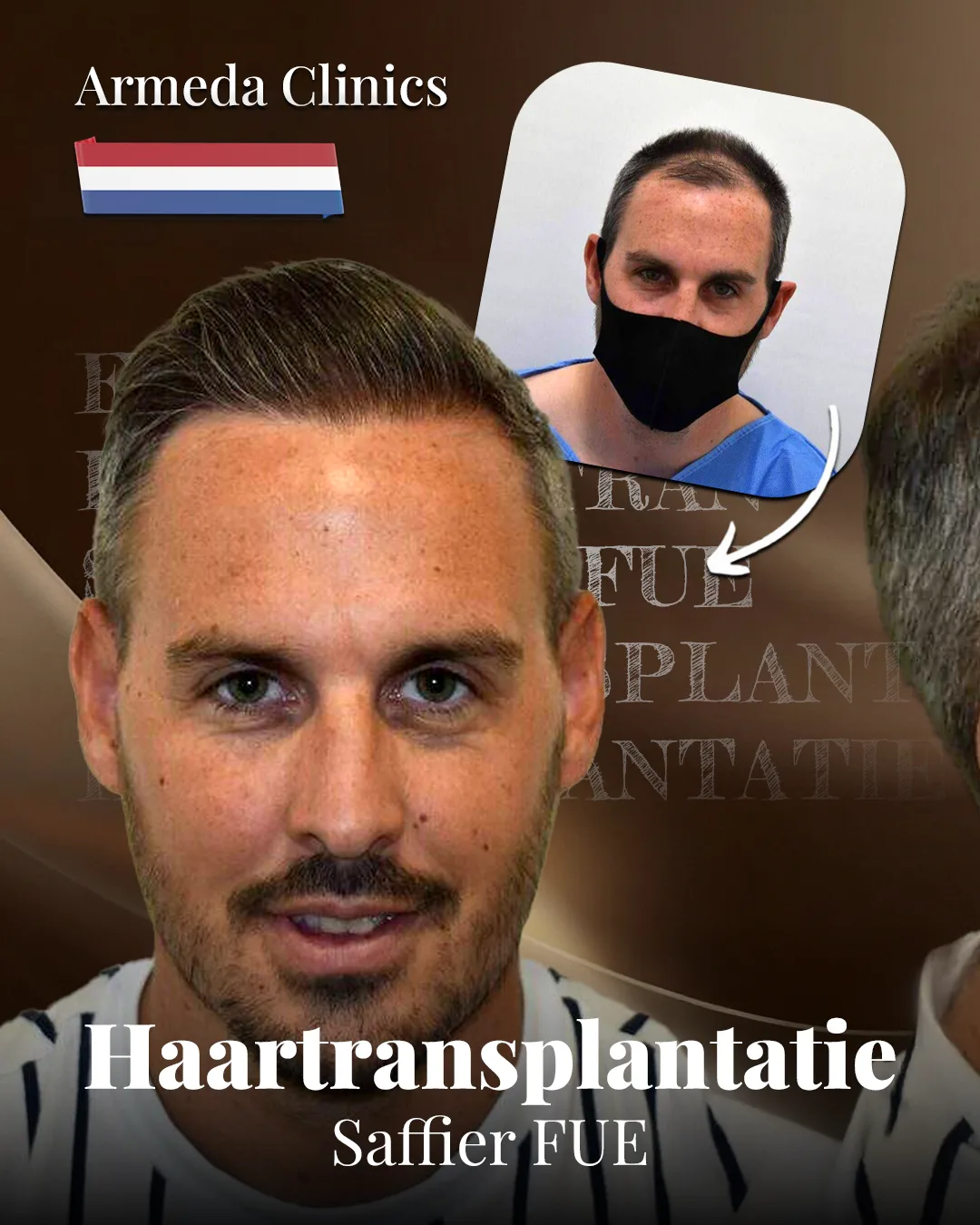 Situatie voor en na de behandeling naast elkaar