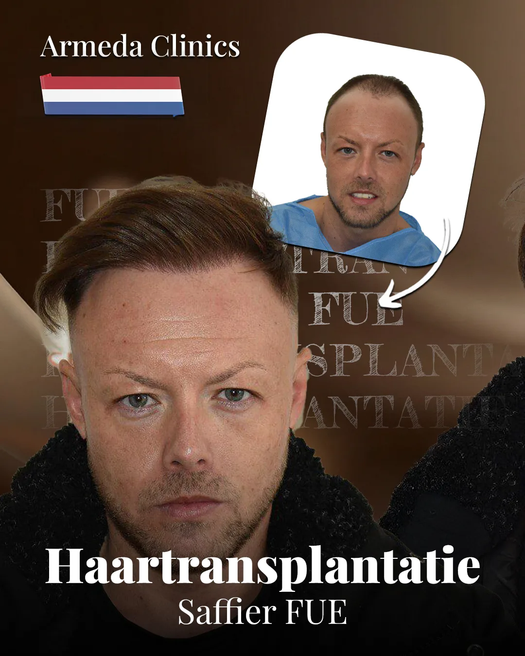 Situatie voor en na de behandeling naast elkaar