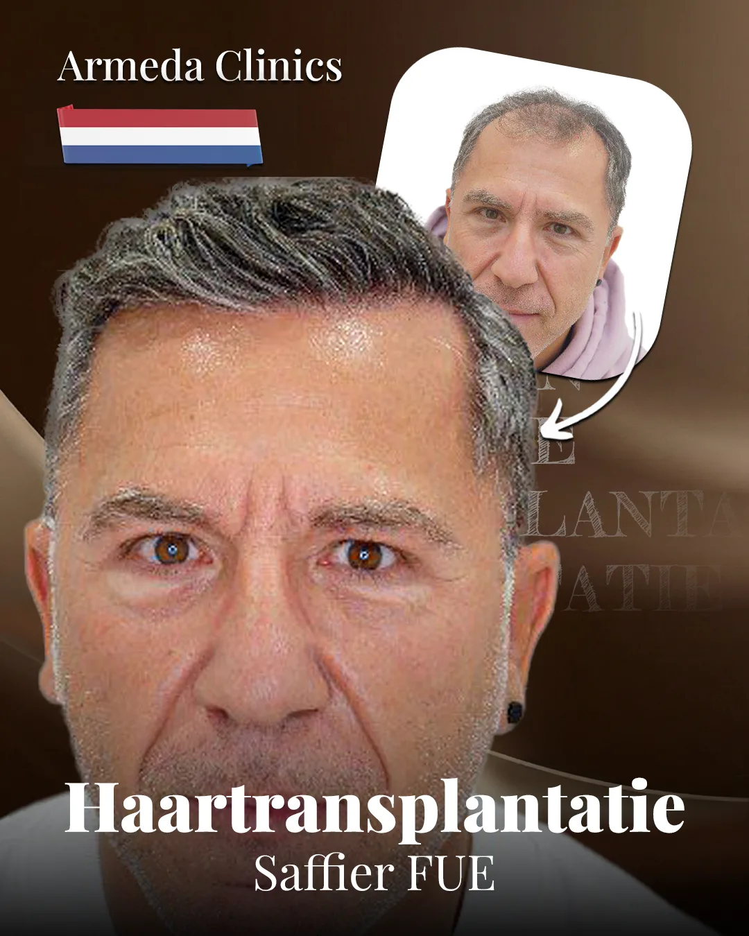 Situatie voor en na de behandeling naast elkaar