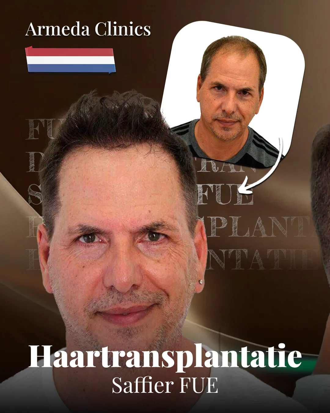 Situatie voor en na de behandeling naast elkaar