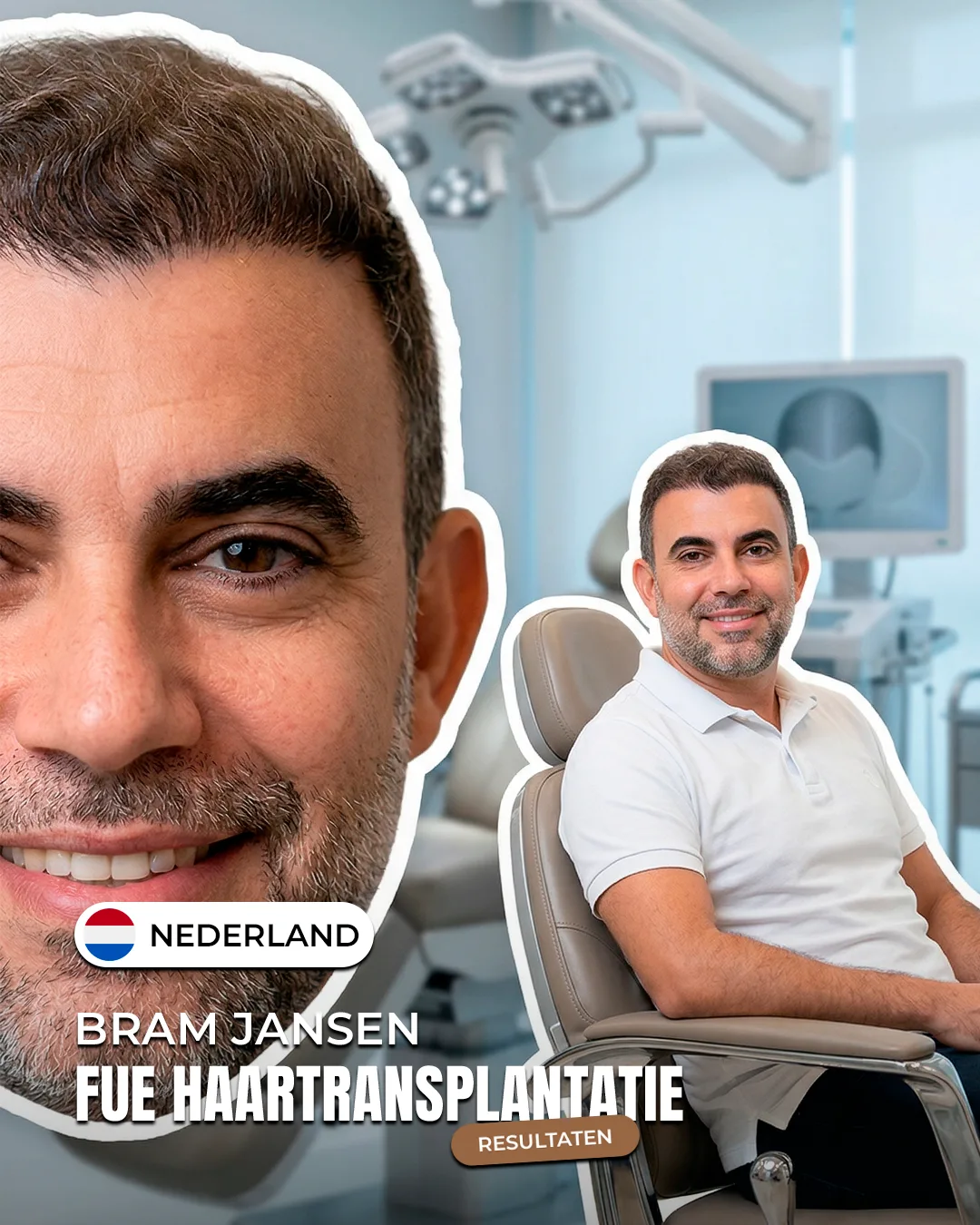 Bram Jansen — FUE haartransplantatie